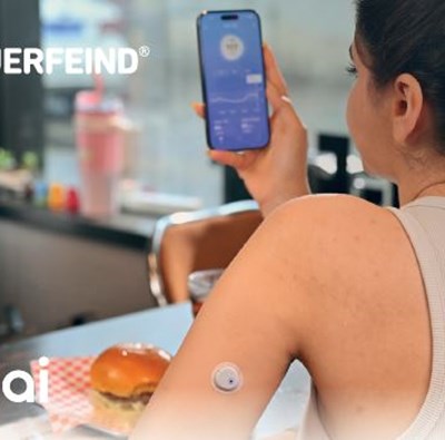 Iskustvo korisnice: Kako mi je Syai X1 senzor poboljšao kontrolu dijabetesa i kvalitetu života