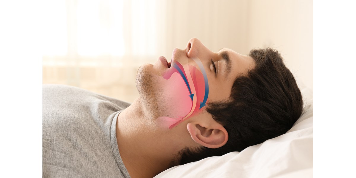 Kako CPAP aparat pomaže kod apneje